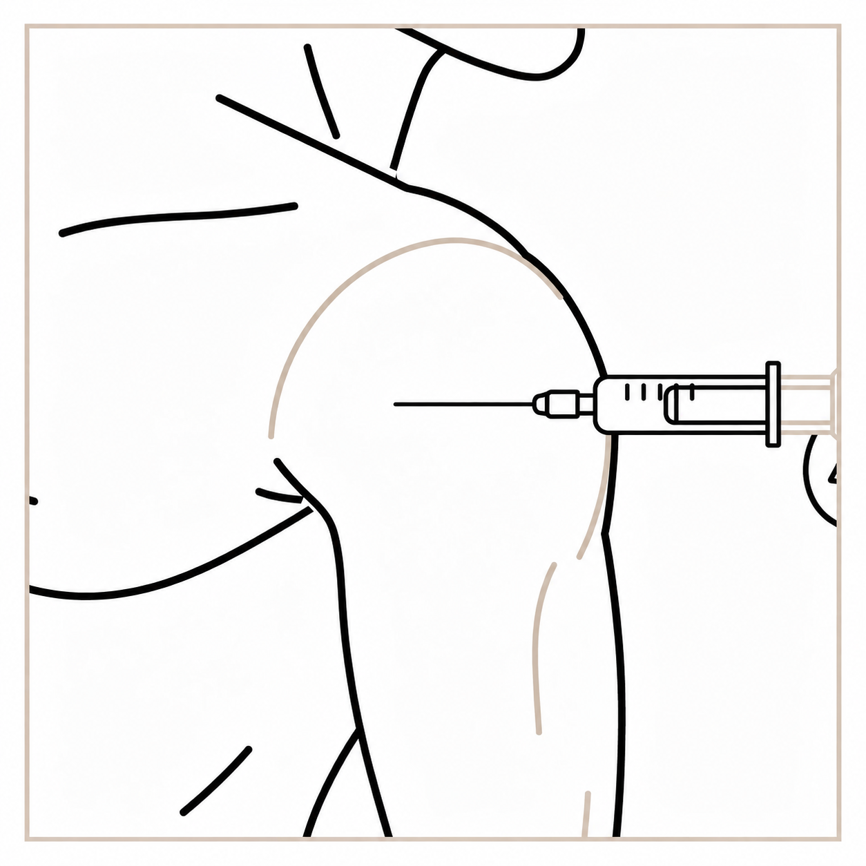 Illustration of the shoulder and upper arm